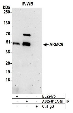 ARMC6 Polyclonal Antibody, Bethyl Laboratories:Antibodies:Primary Antibodies