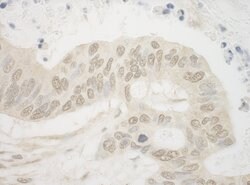 ARNT Rabbit anti-Human, Polyclonal, Bethyl Laboratories 10 &mu;L; Unconjugated:Antibodies,