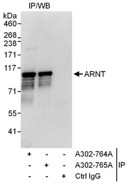 ARNT Rabbit anti-Human, Polyclonal, Bethyl Laboratories 100 &mu;L; Unconjugated:Antibodies,