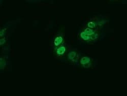 ARNTL Monoclonal Antibody (OTI1D1), TrueMAB , OriGene 30 &mu;L; Unconjugated:Antibodies,