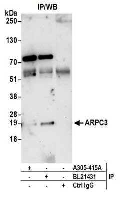 ARPC3 Rabbit anti-Human, Mouse, Polyclonal, Bethyl Laboratories 100 &mu;L;
