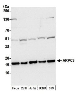 ARPC3 Polyclonal Antibody, Bethyl Laboratories 20 &mu;L | Buy Online | Bethyl Laboratories, Inc | Fisher Scientific