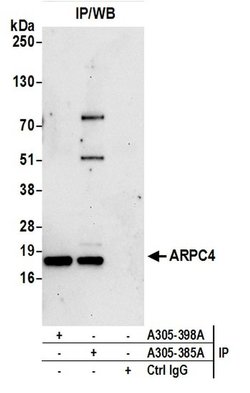 ARPC4 Rabbit anti-Human, Polyclonal, Bethyl Laboratories 10 &mu;L; Unconjugated:Antibodies,