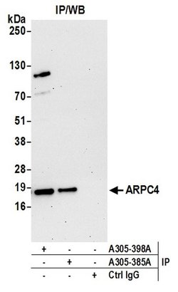 ARPC4 Rabbit anti-Human, Mouse, Polyclonal, Bethyl Laboratories 100 &mu;L;