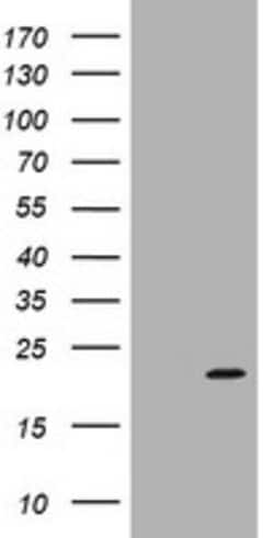 ARPC5 Mouse anti-Human, Clone: OTI2G1, lyophilized, TrueMAB 100 &mu;g;