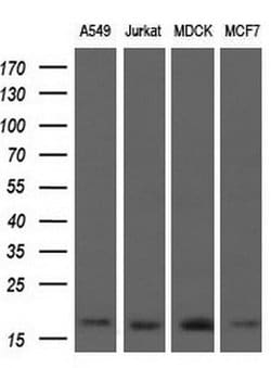 ARPC5 Mouse anti-Human, Clone: OTI2G1, lyophilized, TrueMAB 100 &mu;g;