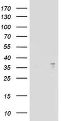 ART1 Monoclonal Antibody (OTI6E2), TrueMAB , OriGene 100 &mu;L; Unconjugated:Antibodies,