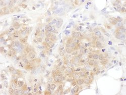 AS160 Rabbit anti-Human, Polyclonal, Bethyl Laboratories 100 &mu;L; Unconjugated:Antibodies,