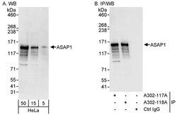 ASAP1 Rabbit anti-Human, Polyclonal, Bethyl Laboratories 100 &mu;L; Unconjugated:Antibodies,