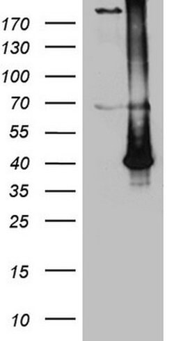 ASB13 Mouse anti-Human, Clone: OTI3B2, lyophilized, TrueMAB 100 &mu;g;