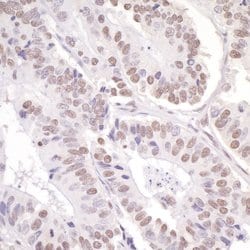 ASC2 Rabbit anti-Human, Polyclonal, Bethyl Laboratories 100 &mu;L; Unconjugated:Antibodies,