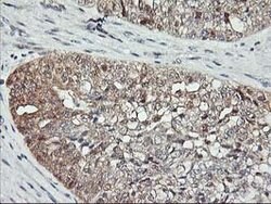 ASCC1 Mouse anti-Human, Clone: OTI6G5, lyophilized, TrueMAB 100 &mu;g;