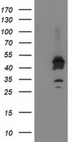 ASCC1 Monoclonal Antibody (OTI1E2), TrueMAB , OriGene 30 &mu;L; Unconjugated:Antibodies,