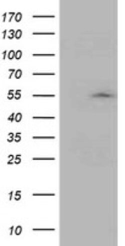 ASCC1 Mouse anti-Human, Clone: OTI6G5, lyophilized, TrueMAB 100 &mu;g;