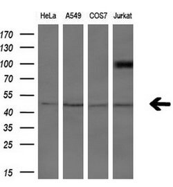 ASCC1 Mouse anti-Human, Clone: OTI6G5, lyophilized, TrueMAB 100 &mu;g;