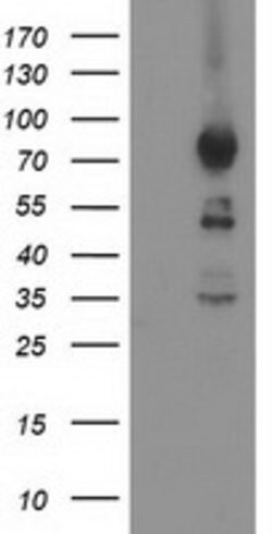 ASCC2 Mouse anti-Human, Clone: OTI1E8, lyophilized, TrueMAB 100 &mu;g;
