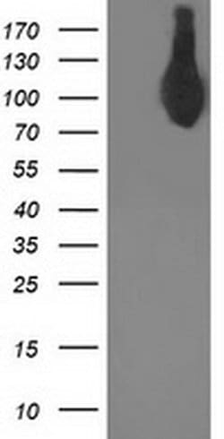 ASCC2 Monoclonal Antibody (OTI2D3), TrueMAB , OriGene:Antibodies:Primary