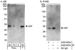 ASF Rabbit anti-Human, Polyclonal, Bethyl Laboratories 100 &mu;L; Unconjugated:Antibodies,