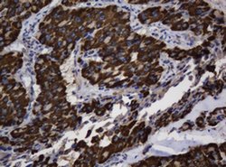ASGR2 Mouse anti-Human, Clone: OTI2A12, liquid, TrueMAB 100 &mu;L; Unconjugated:Antibodies,