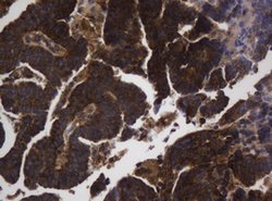 ASGR2 Mouse anti-Human, Clone: OTI2A12, lyophilized, TrueMAB 100 &mu;g;