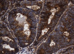 ASGR2 Mouse anti-Human, Clone: OTI2A12, lyophilized, TrueMAB 100 &mu;g;