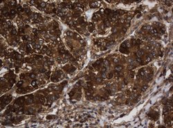 ASGR2 Mouse anti-Human, Clone: OTI2A12, lyophilized, TrueMAB 100 &mu;g;