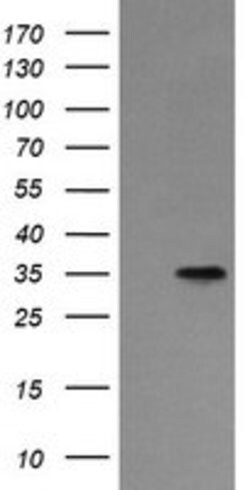 ASGR2 Mouse anti-Human, Clone: OTI4B6, lyophilized, TrueMAB 100 &mu;g;
