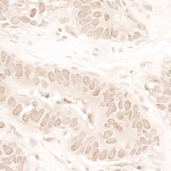 ASH1 Rabbit anti-Human, Mouse, Polyclonal, Bethyl Laboratories 100 &mu;L;