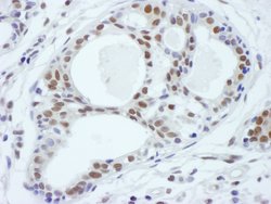 ASH2 Polyclonal Antibody, Bethyl Laboratories 10 &mu;L; Unconjugated:Antibodies,