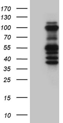 ASH2L Monoclonal Antibody (OTI2H3), TrueMAB , OriGene:Antibodies:Primary