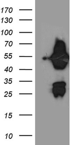 ASL Mouse anti-Human, Clone: OTI9G2, lyophilized, TrueMAB 100 &mu;g; Unconjugated:Antibodies,