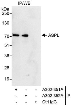 ASPL Rabbit anti-Human, Polyclonal, Bethyl Laboratories 100 &mu;l; Unlabeled:Antibodies,