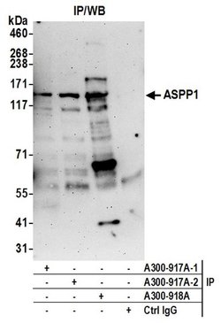 ASPP1 Rabbit anti-Human, Polyclonal, Bethyl Laboratories 10 &mu;l; Unlabeled:Antibodies,