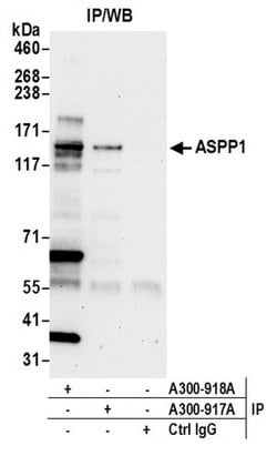 ASPP1 Rabbit anti-Human, Polyclonal, Bethyl Laboratories 100 &mu;L; Unconjugated:Antibodies,
