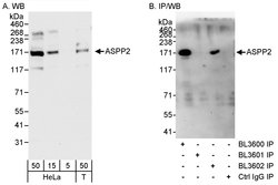 ASPP2 Rabbit anti-Human, Polyclonal, Bethyl Laboratories 100 &mu;L; Unconjugated:Antibodies,