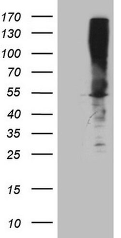 ASS1 Monoclonal Antibody (OTI4G9), TrueMAB , OriGene 100 &mu;L; Unconjugated:Antibodies,