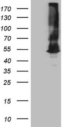 ASS1 Mouse anti-Human, Clone: OTI8A3, lyophilized, TrueMAB 100 &mu;g; Unconjugated:Antibodies,