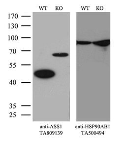 ASS1 Mouse anti-Human, Clone: OTI8A3, lyophilized, TrueMAB 100 &mu;g; Unconjugated:Antibodies,