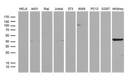 ASS1 Monoclonal Antibody (OTI3D1), TrueMAB , OriGene 30 &mu;L; Unconjugated:Antibodies,