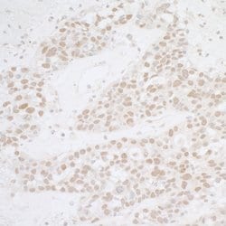 ATF1 Rabbit anti-Human, Polyclonal, Bethyl Laboratories 100 &mu;L; Unconjugated:Antibodies,