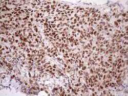 ATF1 Mouse anti-Human, Clone: OTI2B4, lyophilized, TrueMAB 100 &mu;g; Unconjugated:Antibodies,