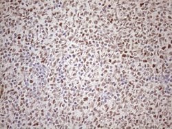 ATF1 Monoclonal Antibody (OTI2B4), TrueMAB , OriGene:Antibodies:Primary
