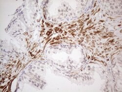 ATF1 Monoclonal Antibody (OTI7H3), TrueMAB , OriGene 100 &mu;L; Unconjugated:Antibodies,