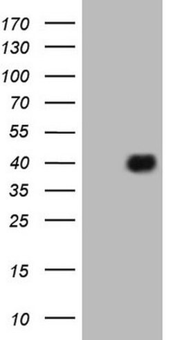 ATF1 Mouse anti-Human, Clone: OTI2B4, lyophilized, TrueMAB 100 &mu;g; Unconjugated:Antibodies,
