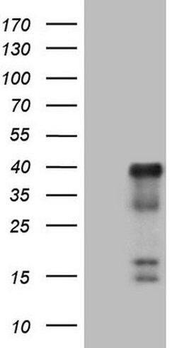 ATF1 Monoclonal Antibody (OTI6B7), TrueMAB , OriGene 100 &mu;L; Unconjugated:Antibodies,