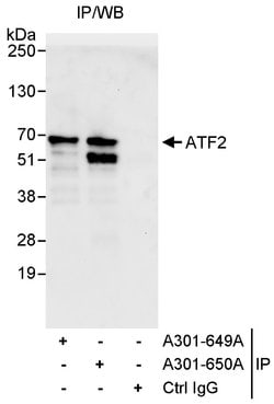 ATF2 Rabbit anti-Human, Polyclonal, Bethyl Laboratories 10 &mu;L; Unconjugated:Antibodies,
