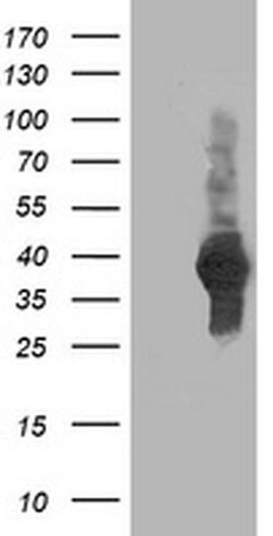 ATG3 Monoclonal Antibody (OTI3G3), TrueMAB , OriGene 100 &mu;L; Unconjugated:Antibodies,