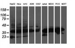 ATG3 Monoclonal Antibody (OTI3G3), TrueMAB , OriGene:Antibodies:Primary