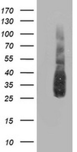 ATG3 Monoclonal Antibody (OTI3C6), TrueMAB , OriGene 100 &mu;L; Unconjugated:Antibodies,