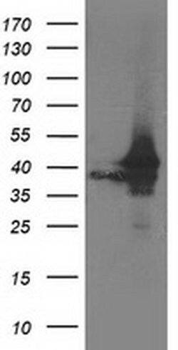 ATG3 Monoclonal Antibody (OTI3H1), TrueMAB , OriGene:Antibodies:Primary